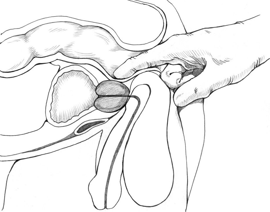 A masaxe de próstata pertence ao complexo de métodos para o tratamento da prostatite