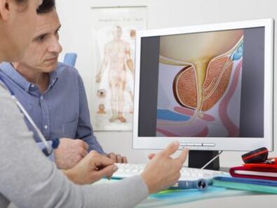 Un urólogo aconsella ao paciente sobre a prostatite e os métodos para tratala.